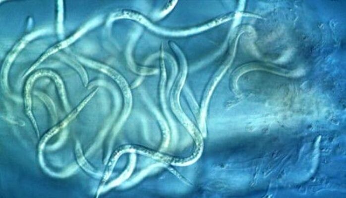 kako izgledaju paraziti nematoda u ljudskom tijelu