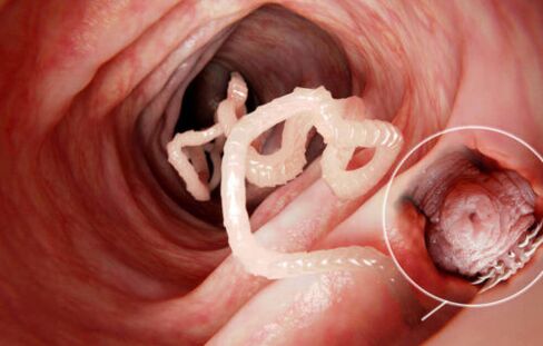 crv je parazit u ljudskom tijelu