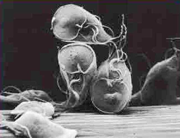 protozoa parazit giardia